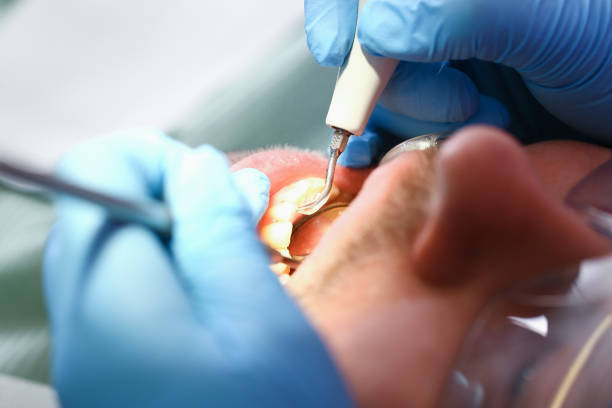 Best Emergency Treatment for Oral Infections in Walkertown, NC