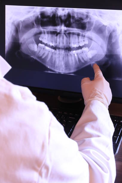 Best Dental Abscess Treatment in Walkertown, NC